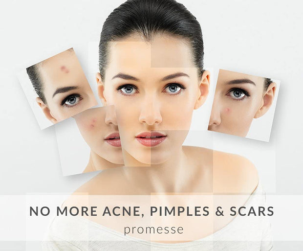 Acne Control Facial Cleanser - Anti-Aging Exfoliating Wash with Glycolic & Salicylic Acid, Rose-Scented, Made in USA, Organic & Natural Ingredients