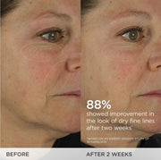 the Dewy Skin Cream | Rich Face Cream to Hydrate, Plump and Protect Dry and Combo Skin | 10 Ml / 0.34 Oz