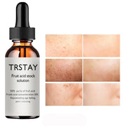 20% Glycolic Acid Oil Liquid anti Wrinkles Face Cream Whitening Skin Care Anti-Aging Serum Skin Care Products