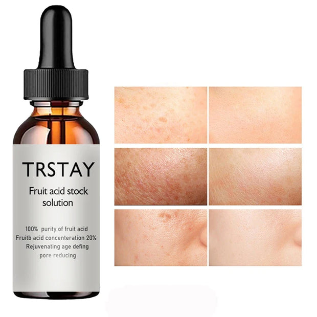 20% Glycolic Acid Oil Liquid anti Wrinkles Face Cream Whitening Skin Care Anti-Aging Serum Skin Care Products