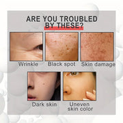 20% Glycolic Acid Oil Liquid anti Wrinkles Face Cream Whitening Skin Care Anti-Aging Serum Skin Care Products