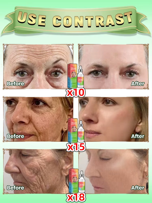 Retinol Serum for Reducing Fine Lines, Moisturizing, Wrinkle Removal, Facial Skin Care, Korean Skin Care 30G, Facial Care