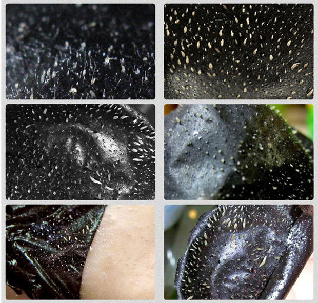 Triple Action Blackhead Control Skincare Kit