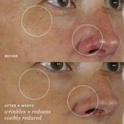 the Silk Serum Wrinkle-Smoothing Retinol Alternative | 30 Ml / 1 Oz