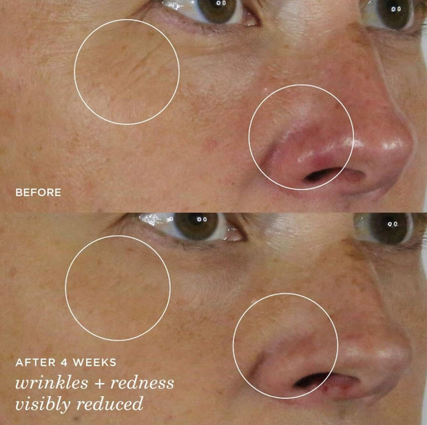 the Silk Serum Wrinkle-Smoothing Retinol Alternative | 30 Ml / 1 Oz